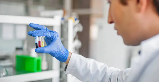 Photo of Male lab technician holding a test tube with sample