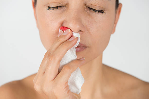 mujer con hemorragia nasal - gauze bandage adhesive bandage healthcare and medicine fotografías e imágenes de stock