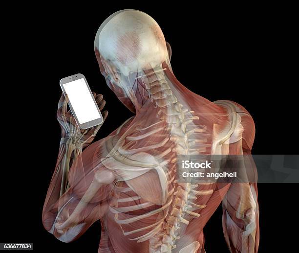Human Anatomy Showing Wrong Postures Of Using The Phone Stock Photo - Download Image Now