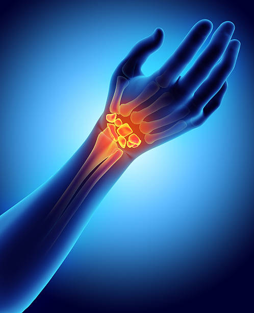 istock 3D illustration of Carpal, medical concept. 636678464