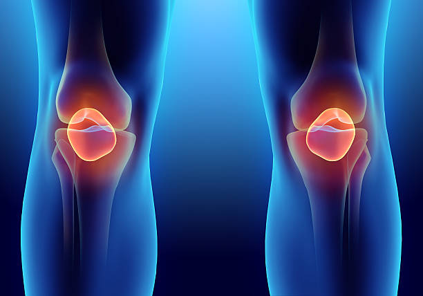ilustração 3d de rótula, conceito médico. - human joint human knee pain x ray imagens e fotografias de stock