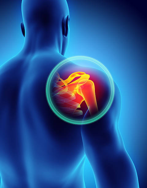 istock Shoulder painful skeleton x-ray, 3D illustration. 636682320