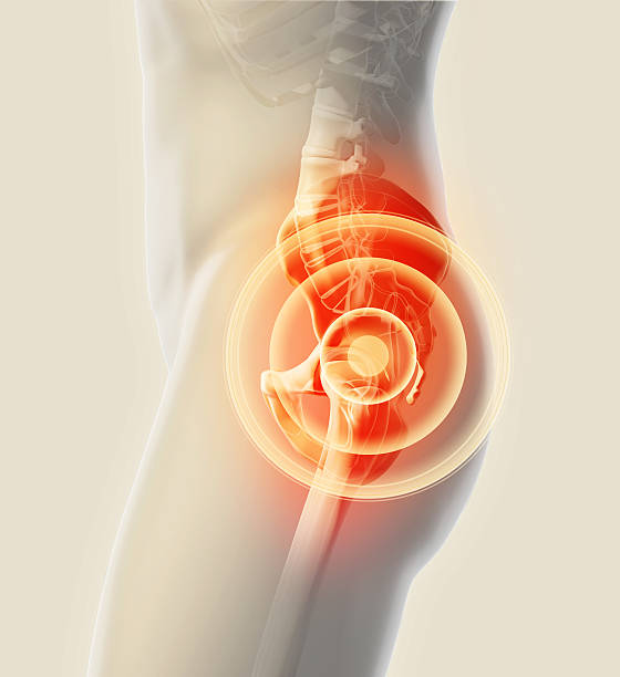 radiographie du squelette douloureux de la hanche, illustration 3d. - hip femur ilium pelvis photos et images de collection