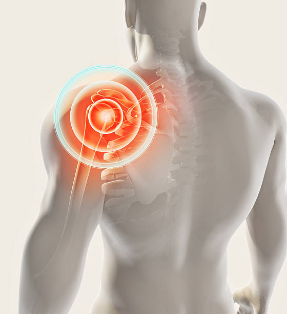 radiografía del esqueleto doloroso del hombro, ilustración 3d. - pain shoulder human joint cramp fotografías e imágenes de stock