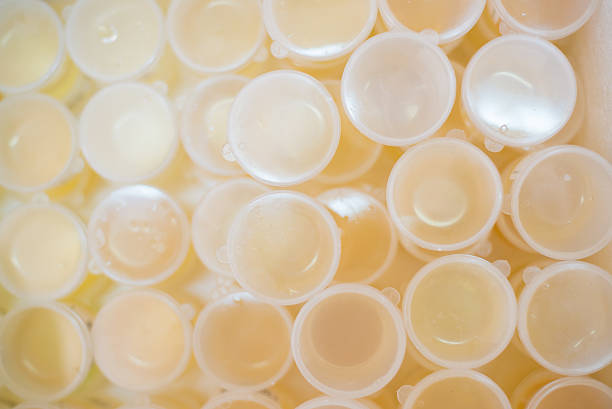 istock urine analysis in laboratory in white tone. 636763008