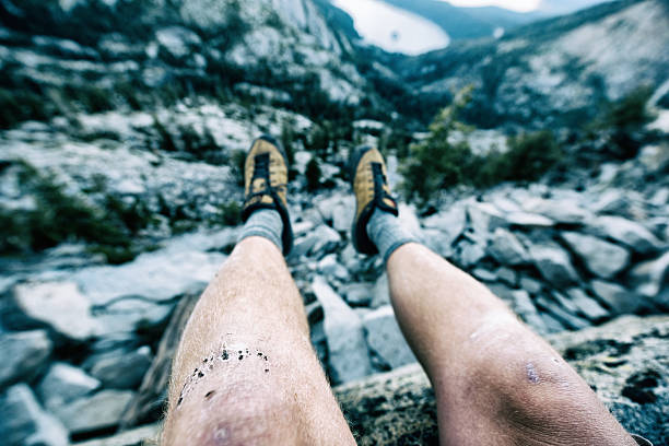 istock Banged up knees after climbing in Lake Tahoe, Ca 636890982