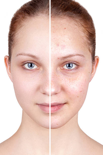 istock Befor and after treatment. 636943296