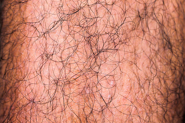 istock Male Hairy Leg Detail 636949906
