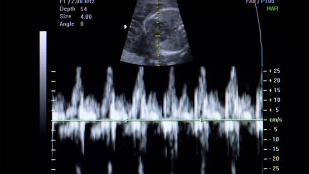 Ultrasound image of a baby's heartbeat.