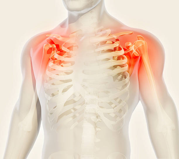 radiografía del esqueleto doloroso del hombro, ilustración 3d. - shoulder bone fotografías e imágenes de stock