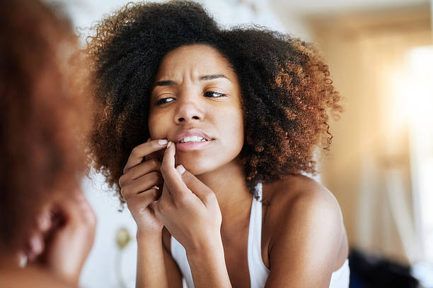 istock When her skin is irritated so is she 637130254