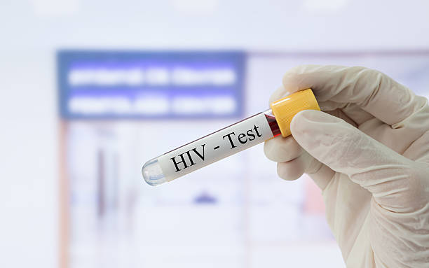 hiv test stock photo