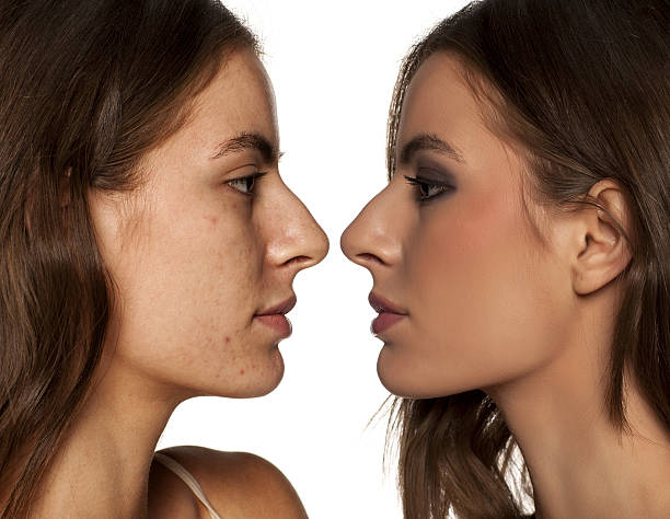 istock comparative portrait of the same woman, with and without makeup 637326086