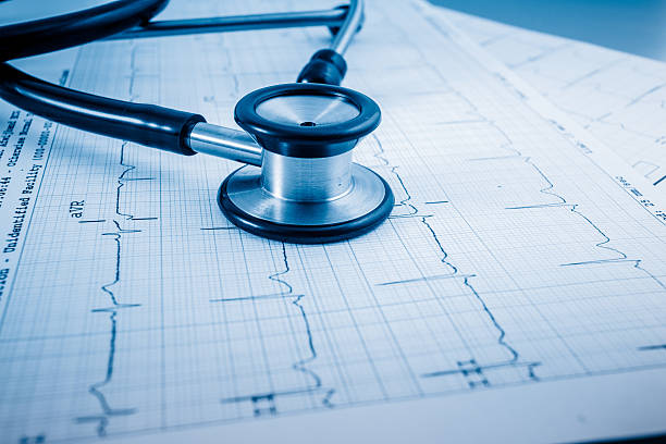 istock Stethoscope on cardiogram concept for heart care 637398296