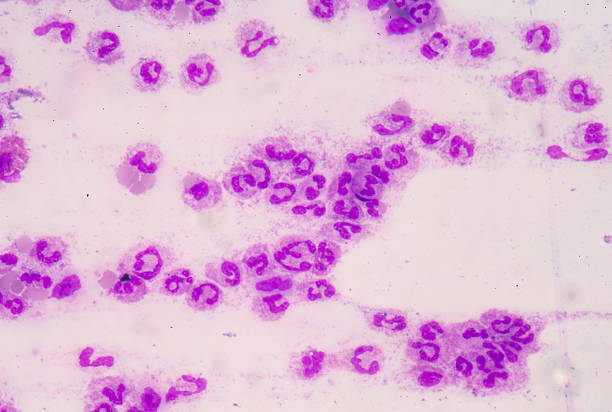 istock Sepsis or septicaemia is a life-threatening illness. 637415646