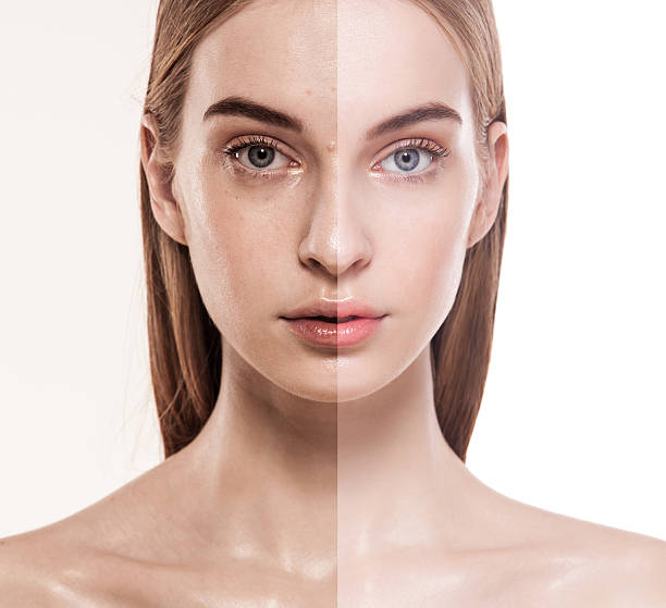 istock before after close up beauty skin shot 637649690