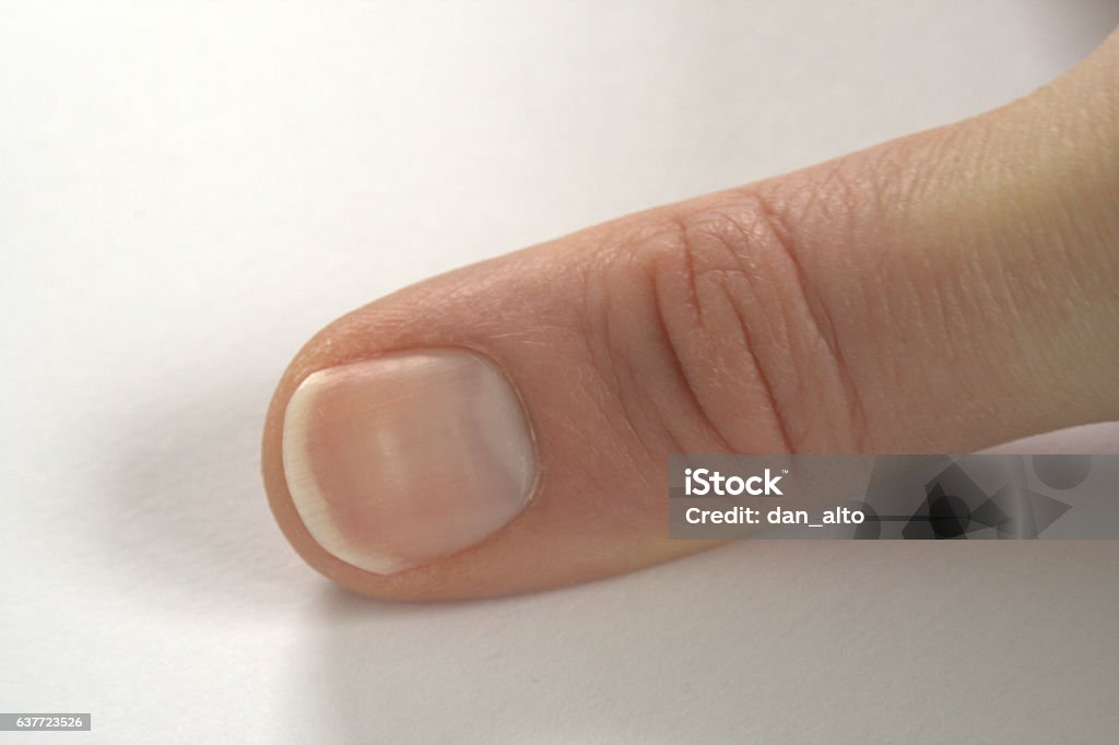 Thumb and Thumbnail Fingernail Stock Photo