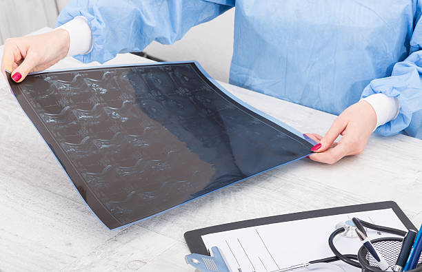 istock Woman Doctor Looking at X-Ray 637761138