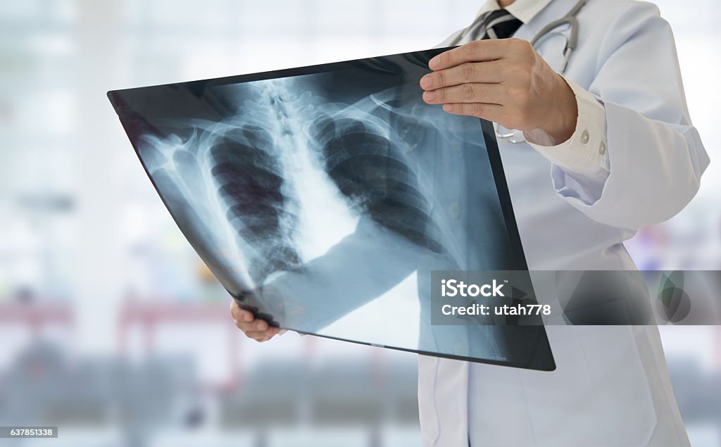 doctor x-ray Doctor examining chest x-ray film of patient at hospital. X-ray Image Stock Photo