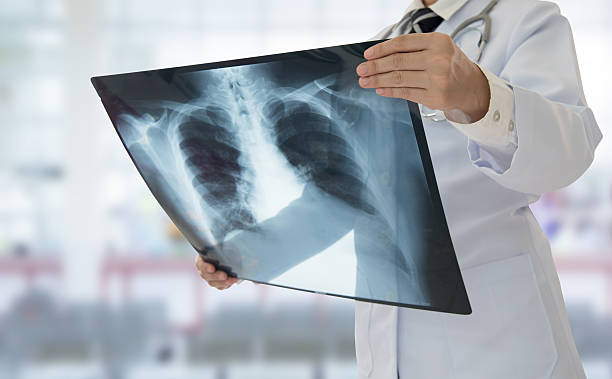 doctor x-ray Doctor examining chest x-ray film of patient at hospital. x ray image stock pictures, royalty-free photos & images