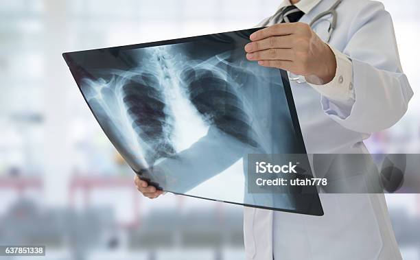 Doctor Xray Stock Photo - Download Image Now - X-ray Image, Medical X-ray, Radiologist