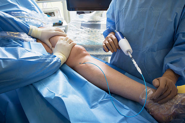 médecins effectuant une intervention chirurgicale veineuse - artère humaine photos et images de collection