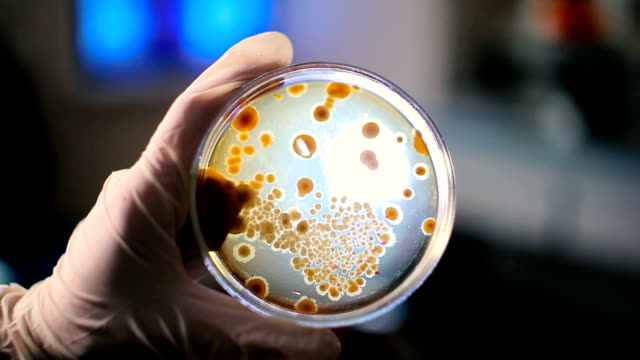 Make scraping colonies of bacteria.