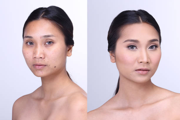 istock Asian Woman before and after make up. no retouch 638082028