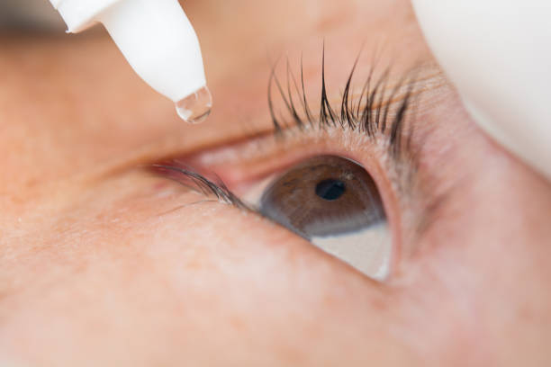 istock Conjunctivitis in the eye women 638093618