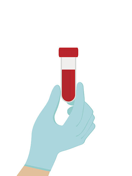 Blood test in the hand of the doctor. Vector, vector art illustration