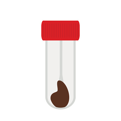 Stool Analysis Test Stock Illustration - Download Image Now - Analyzing ...