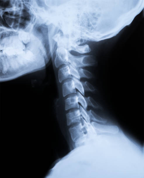首と頭蓋骨のx線 - サイドビュー - radiogram photographic image ストックフォトと画像
