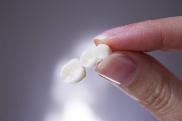 istock Woman hand pointing of false teeth 638343130