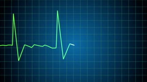 Death Ekg Heart Monitor Goes Flatline Stock Video - Download Video Clip Now - Electrocardiography, Noise, Heartbeat - iStock Death Ekg Heart Monitor Goes Flatline Stock Video - Download Video Clip Now - Electrocardiography, Noise, Heartbeat - iStock