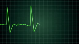 Death Ekg Heart Monitor Goes Flatline Stock Video - Download Video Clip Now  - Electrocardiography, Noise, Heartbeat - iStock