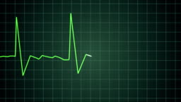 Death Ekg Heart Monitor Goes Flatline Stock Video - Download Video Clip Now - Electrocardiography, Noise, Heartbeat - iStock Death Ekg Heart Monitor Goes Flatline Stock Video - Download Video Clip Now - Electrocardiography, Noise, Heartbeat - iStock