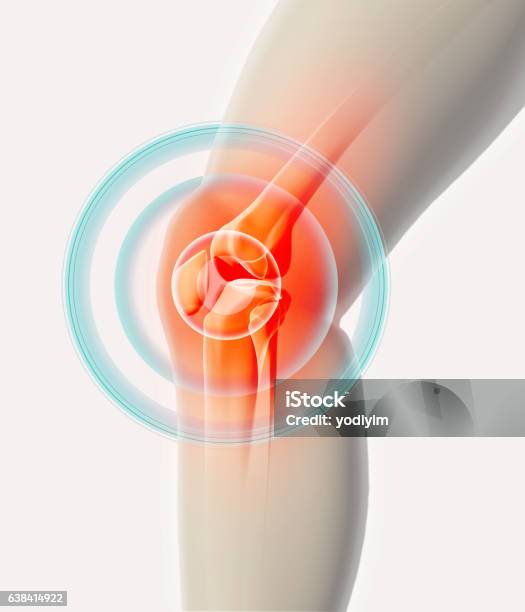 Knee Painful Skeleton Xray Stock Photo - Download Image Now - Joint - Body Part, Osteoarthritis, Pain