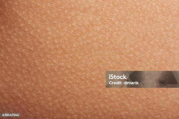 Goose Bumps On Human Skin Stock Photo - Download Image Now - Textured, Textured Effect, Close-up