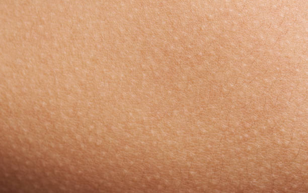 istock Goose bumps on human skin 638447736