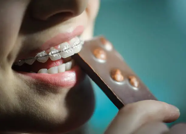 Photo of Girl eating chocolate, with ceramic teeth braces