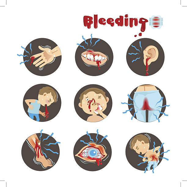 Bleeding Cartoon bleeding in a circle on a white background. Vector illustration. nose bleed stock illustrations