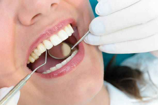 歯科のコンサルティング - dentist dental hygiene dental equipment care ストックフォトと画像