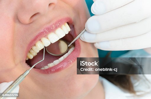 istock Dental Consultation 638651214