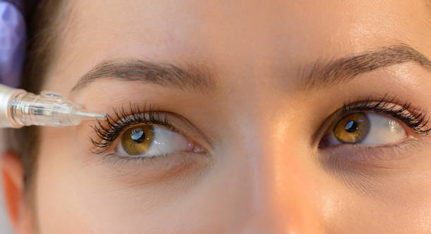 istock Woman Getting Laser Tattoo Procedure 638659170