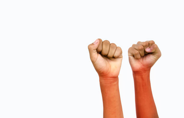 istock Hand for victory with pain 638674354