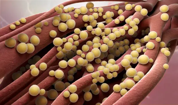 Photo of Staphylococcus aureus