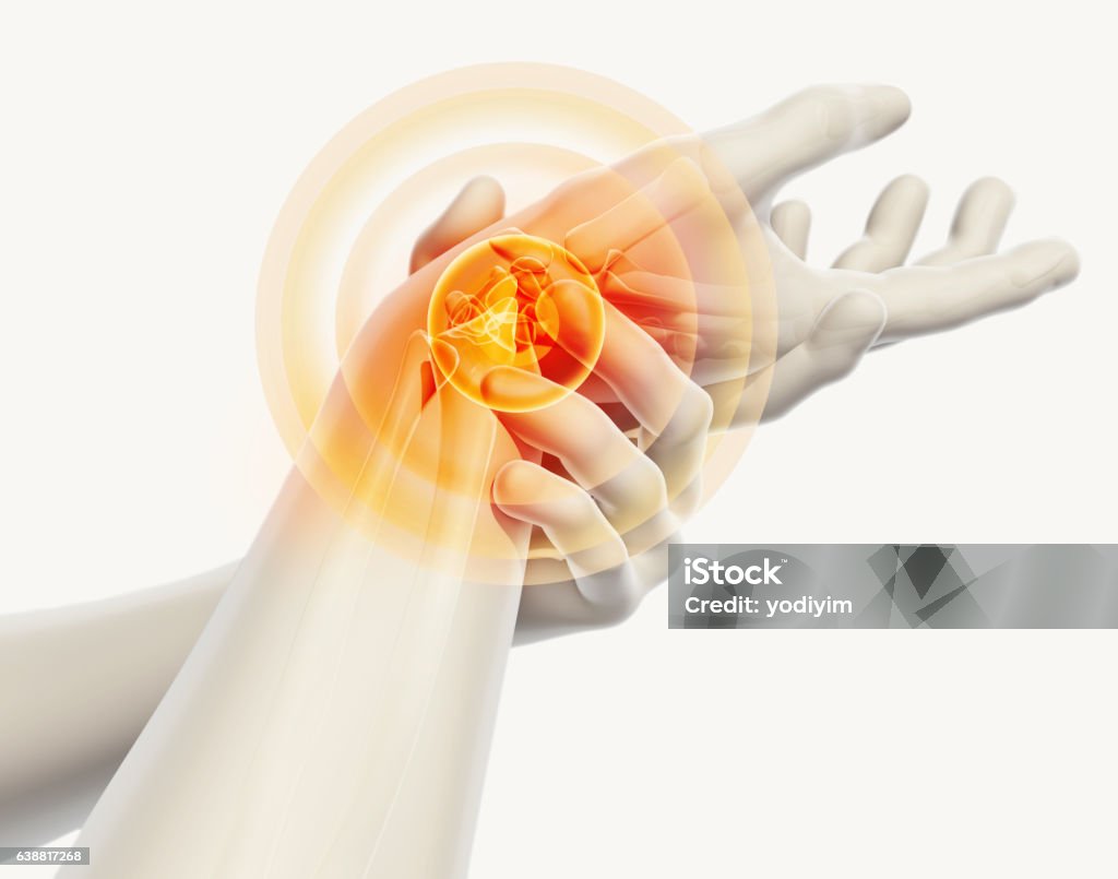 Wrist painful - skeleton x-ray. Wrist painful - skeleton x-ray, 3D Illustration medical concept. Carpal Tunnel Syndrome Stock Photo