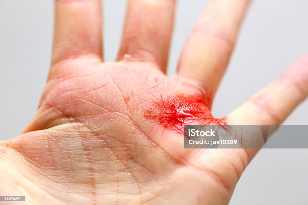 Primo primo di una mano tagliata - Foto stock royalty-free di Ferito