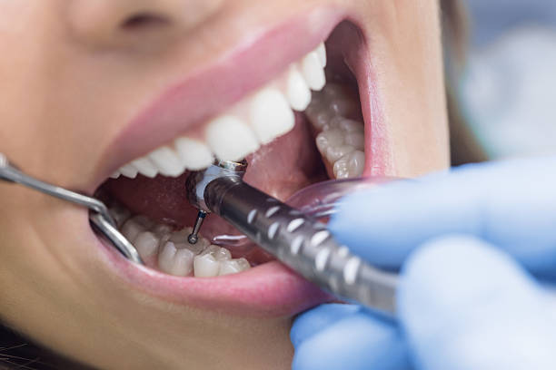 istock Young Woman At The Dentist 638903794