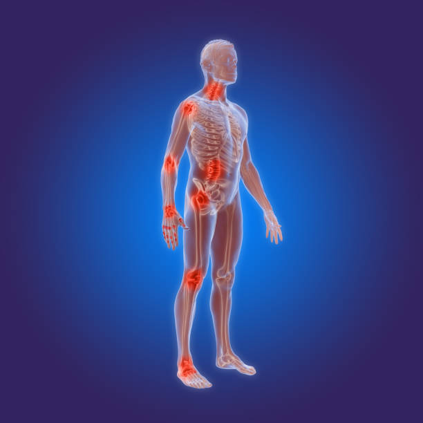 Osteoarthritis - rheumatoid arthritis in the human body stock photo